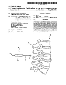 Dr. Neubardt's Spine Surgery Patent 11