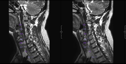 Read Your MRI at Home